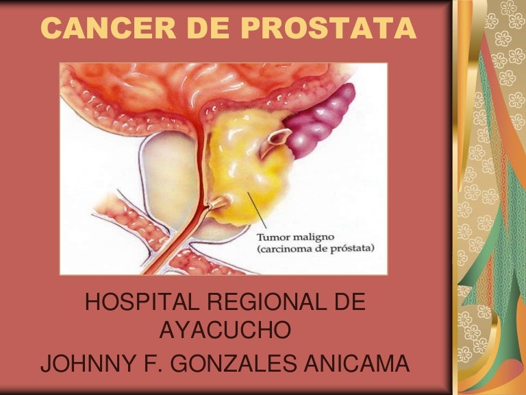 psa totale 2. 5 volume prostata 40 4